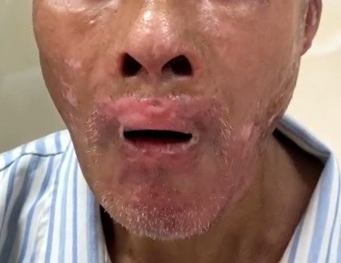 Seo-bong-truoc-pt2jpg