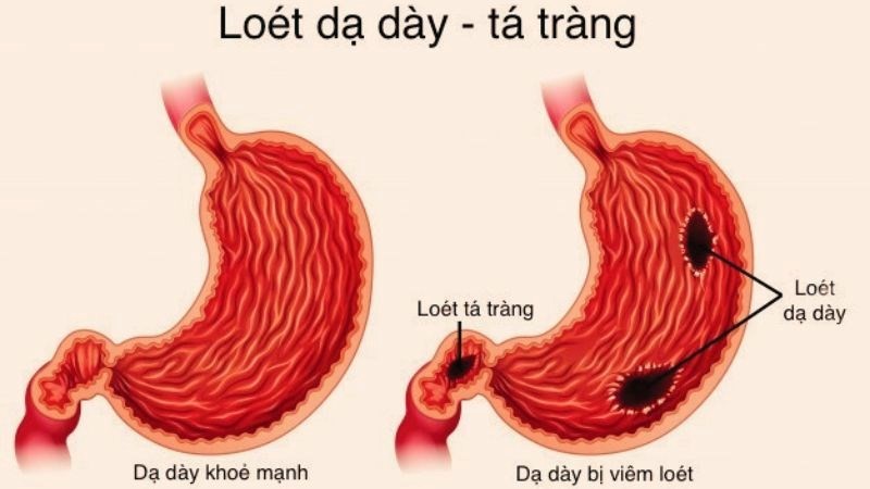 day-day