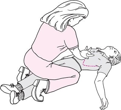 Heimlich-hon-me