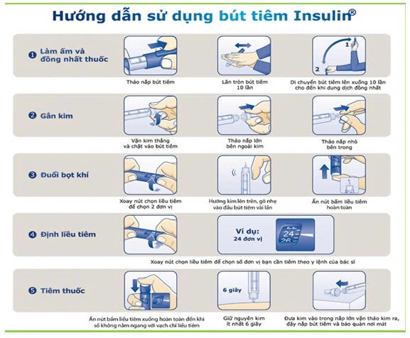 HDSD-BUT-TIEM