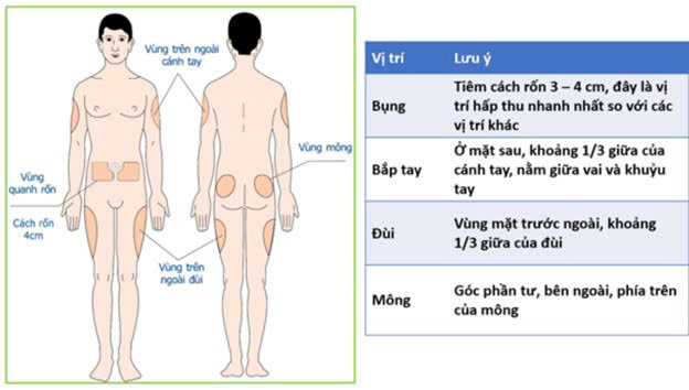 huong-dan-tiem